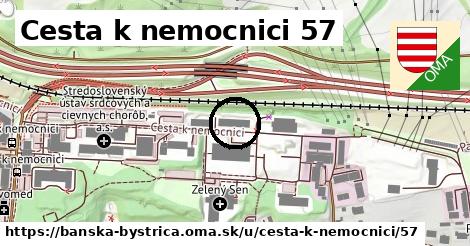 Cesta k nemocnici 57, Banská Bystrica