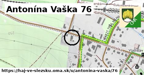 Antonína Vaška 76, Háj ve Slezsku