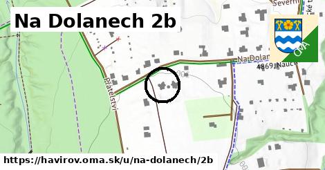 Na Dolanech 2b, Havířov