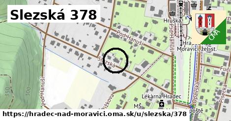 Slezská 378, Hradec nad Moravicí