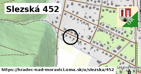 Slezská 452, Hradec nad Moravicí