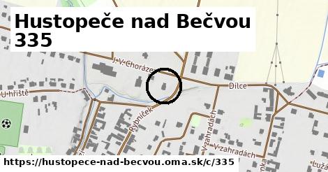 Hustopeče nad Bečvou <span class="supisne">335</span>
