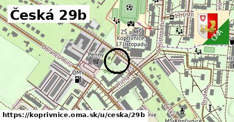 Česká 29b, Kopřivnice