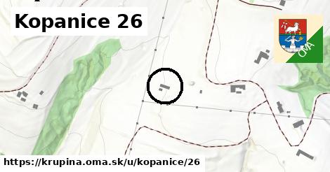 Kopanice 26, Krupina