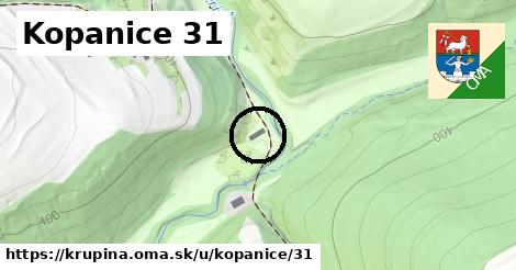 Kopanice 31, Krupina