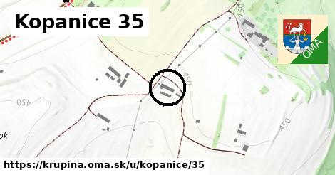 Kopanice 35, Krupina