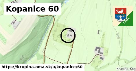 Kopanice 60, Krupina