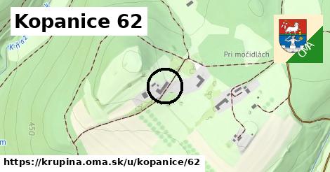 Kopanice 62, Krupina