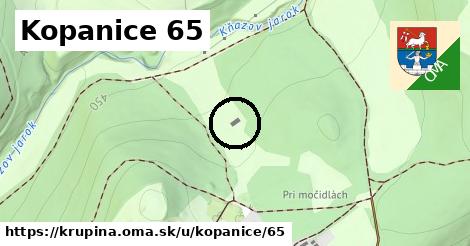 Kopanice 65, Krupina