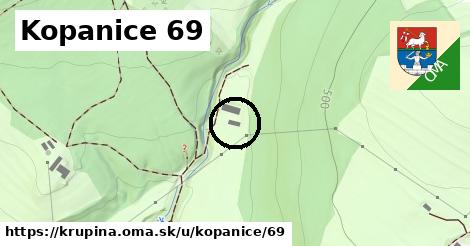 Kopanice 69, Krupina