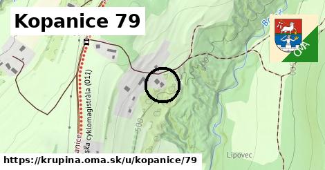 Kopanice 79, Krupina