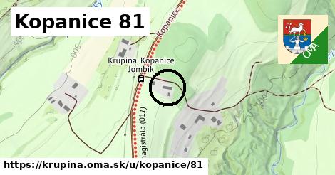 Kopanice 81, Krupina