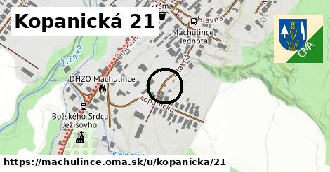 Kopanická 21, Machulince