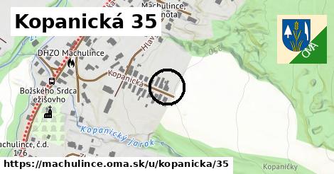 Kopanická 35, Machulince
