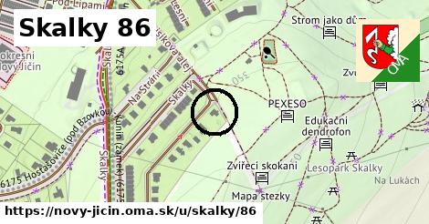 Skalky 86, Nový Jičín