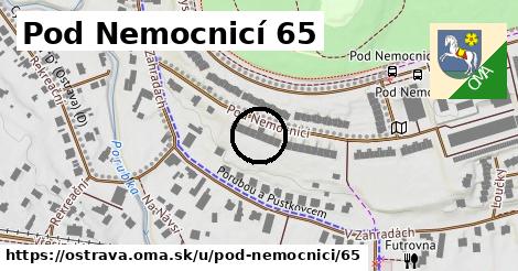 Pod Nemocnicí 65, Ostrava