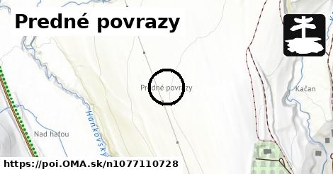 Predné povrazy