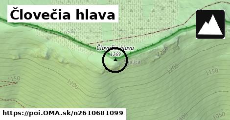 Človečia hlava