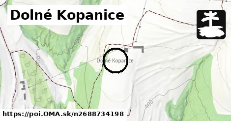 Dolné Kopanice