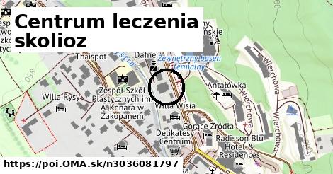 Centrum leczenia skolioz