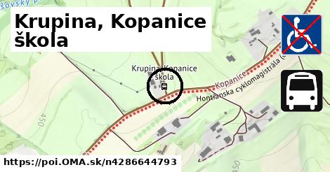 Krupina, Kopanice škola