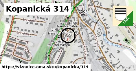 Kopanická 314, Vizovice