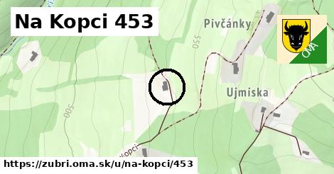 Na Kopci 453, Zubří