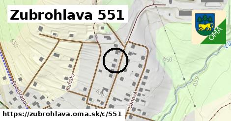 Zubrohlava <span class="supisne">551</span>