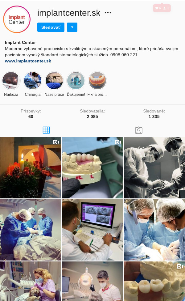 instgram foto @implantcenter.sk