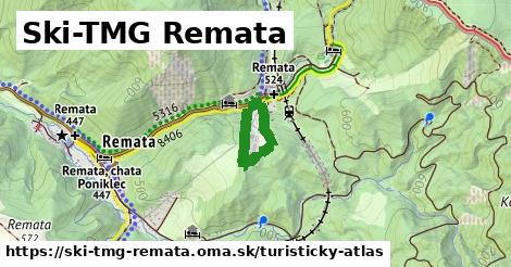 Ski-TMG Remata