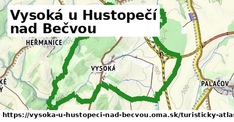 Vysoká u Hustopečí nad Bečvou