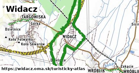 Widacz