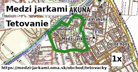tetovanie v Medzi jarkami