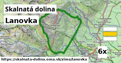 lanovka v Skalnatá dolina