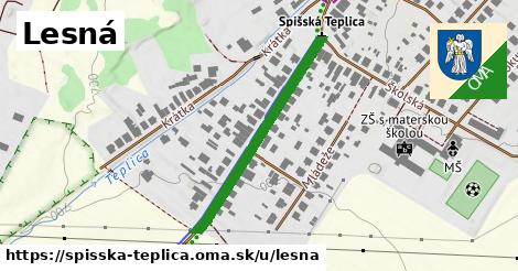 Lesná, Spišská Teplica